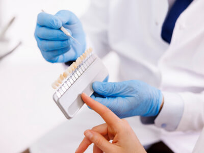 Detail of dentist showing zirconium dental facets color palette to patient