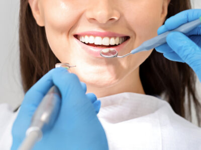 dental bonding Aurora